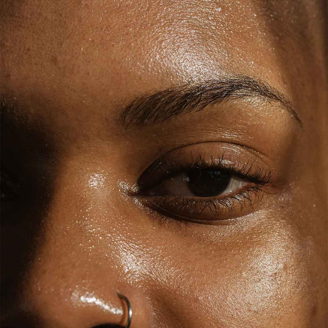 How Do I Know if I Have Oily Skin?