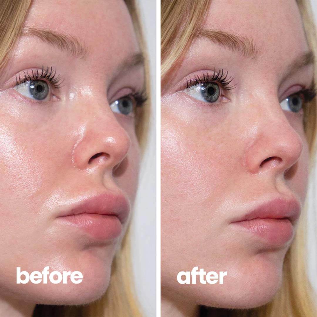 Blotberry™ Shine Control Compact